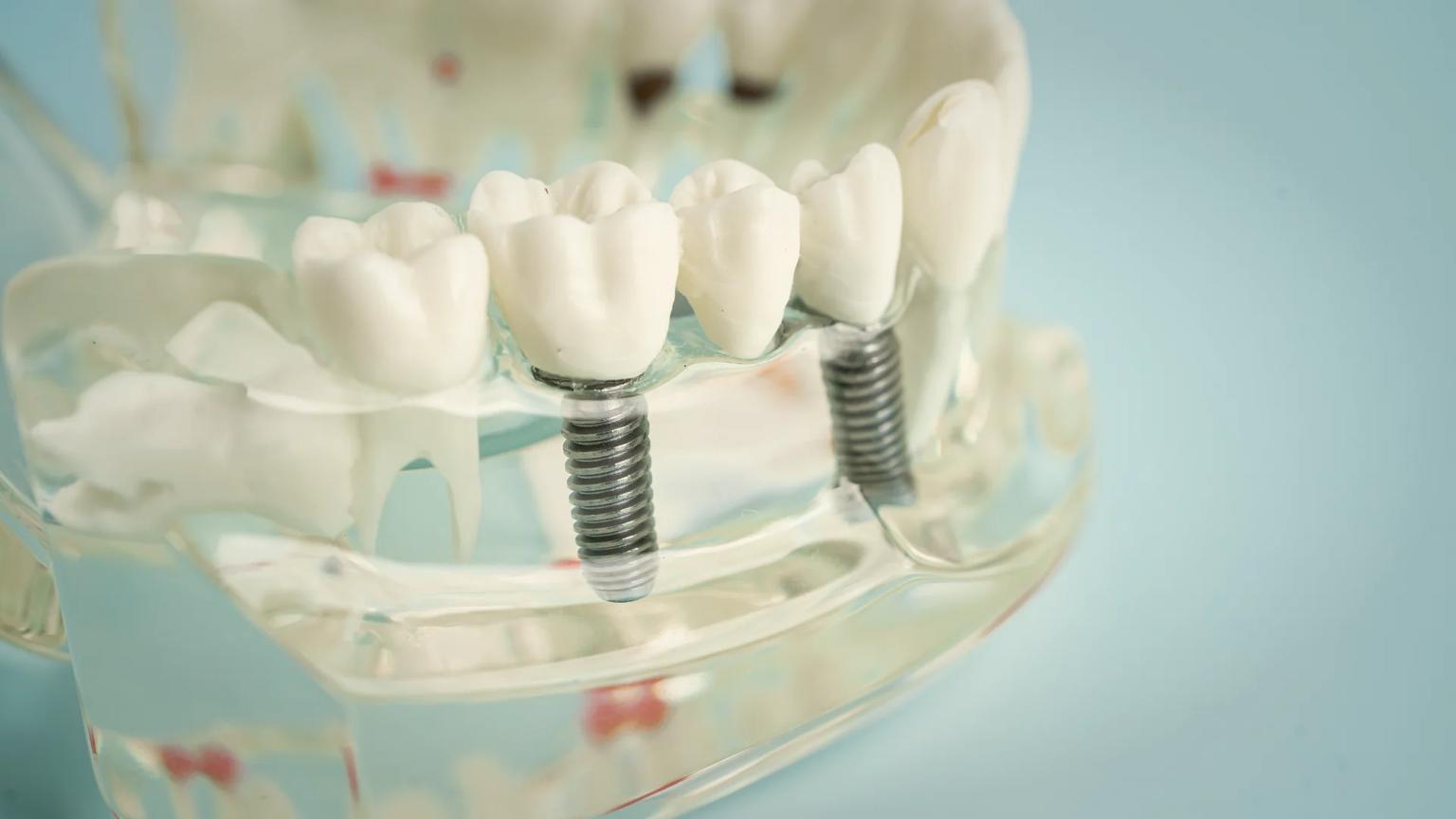 Dental implant surgical suite at an ATDERA Care Network partner facility in Turkey, configured for CBCT imaging and guided implant placement