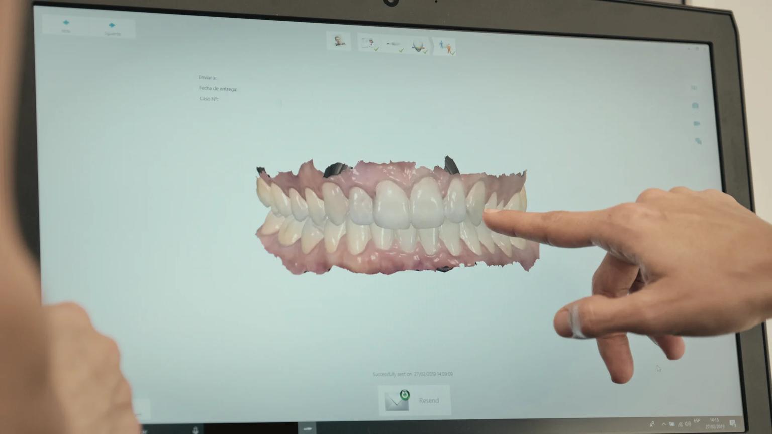 Aesthetic dentistry suite at an ATDERA Care Network partner facility in Turkey, configured for digital smile design, multi-unit shade matching, and porcelain bonding