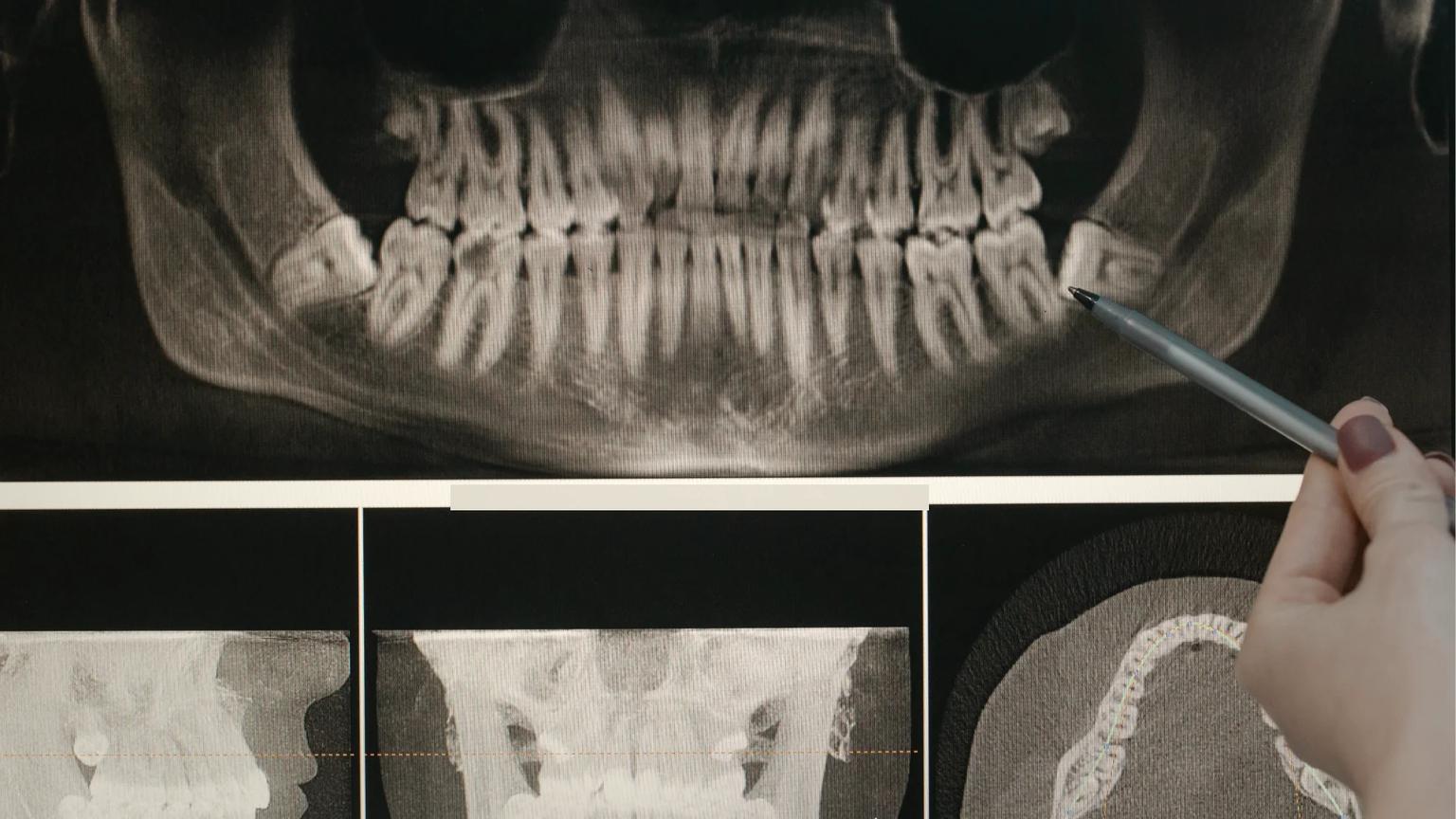 Clinician reviewing a CBCT scan during a dental investment-planning consultation