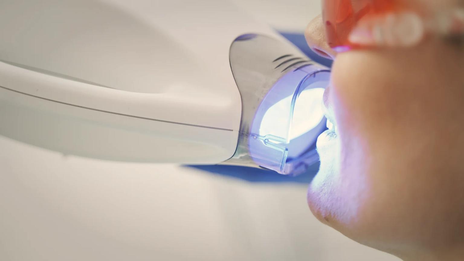 Aesthetic dentistry suite at an ATDERA Care Network partner facility in Turkey, configured for in-clinic professional teeth whitening with shade-guide assessment