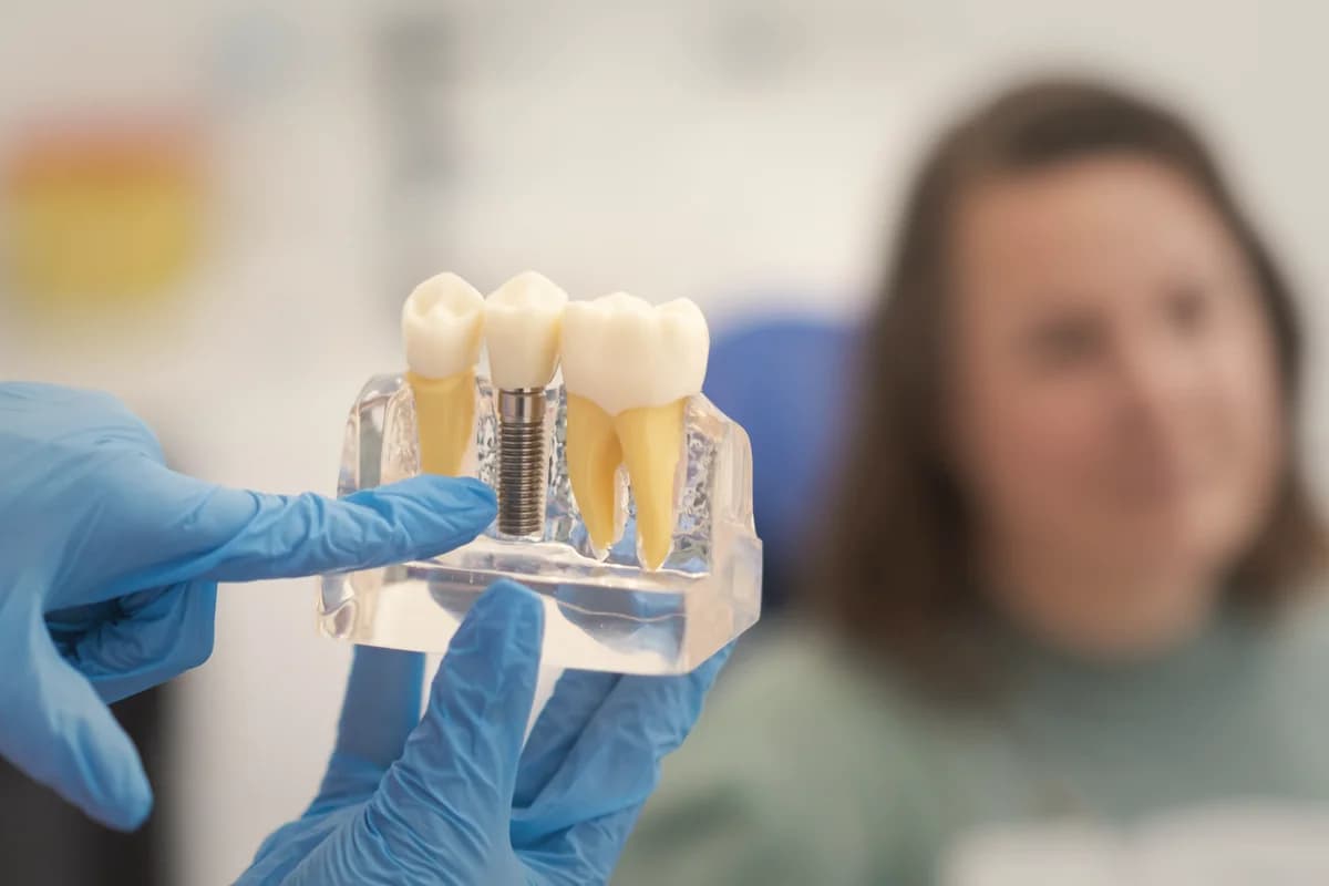 All-on-4 full-arch implant placement with guided surgical template at a partner facility in Turkey