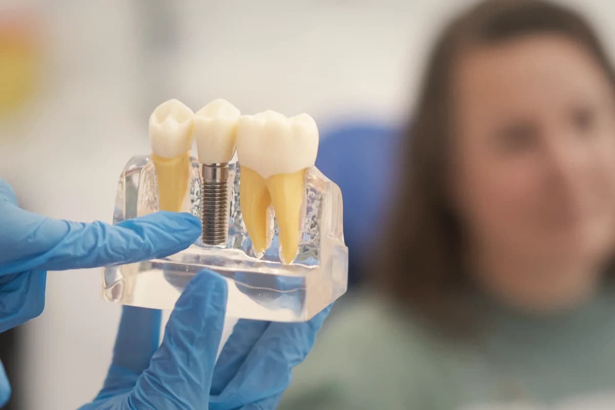 Clinician showing a dental implant model during a consultation