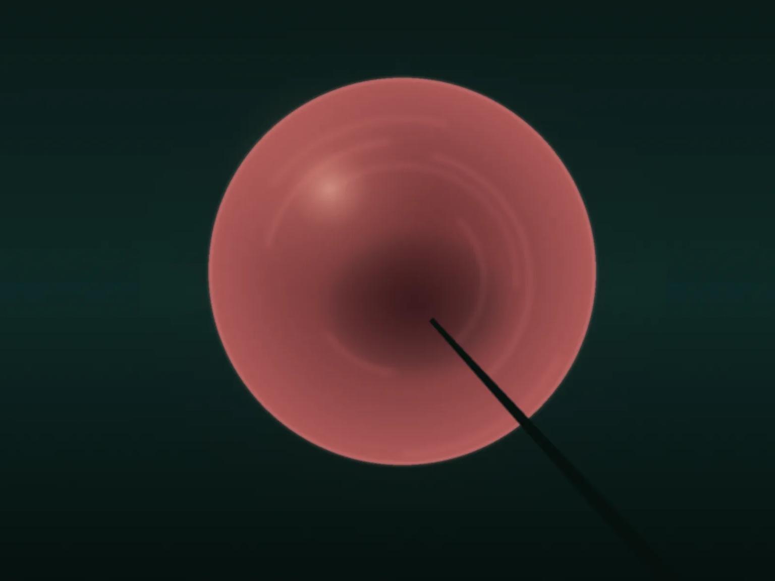 Stylised hysteroscopic view — illuminated cavity and scope